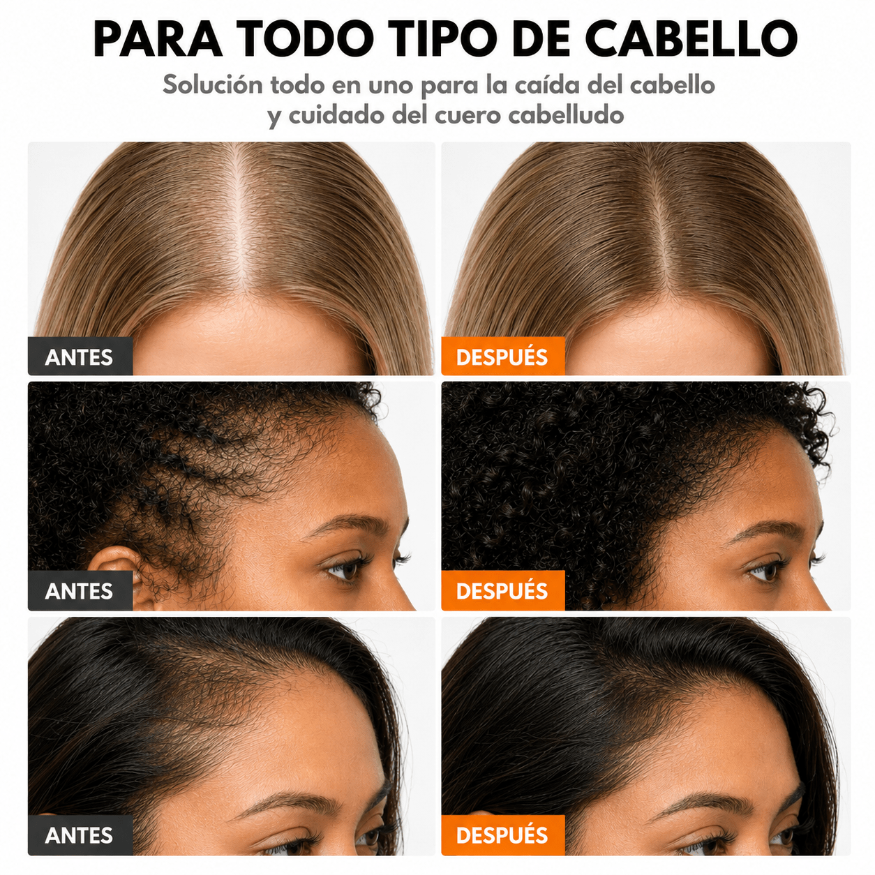 Sérum para el crecimiento del cabello coreano - AVERA